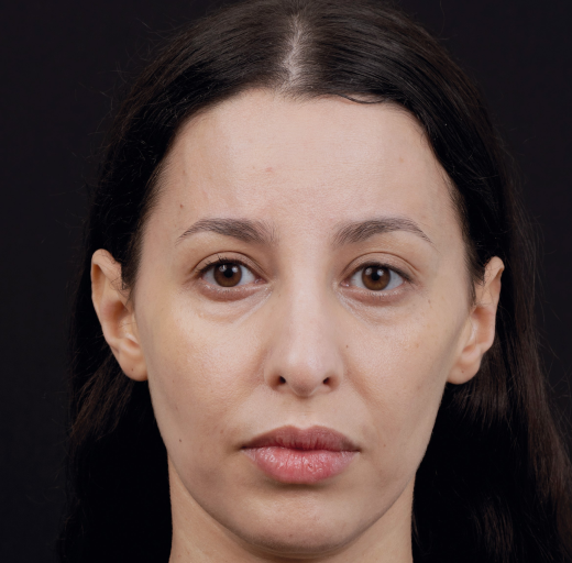 Before/After Image